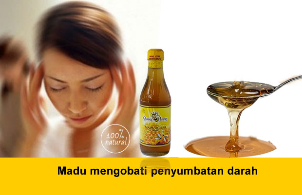 Madu mengobati penyumbatan darah