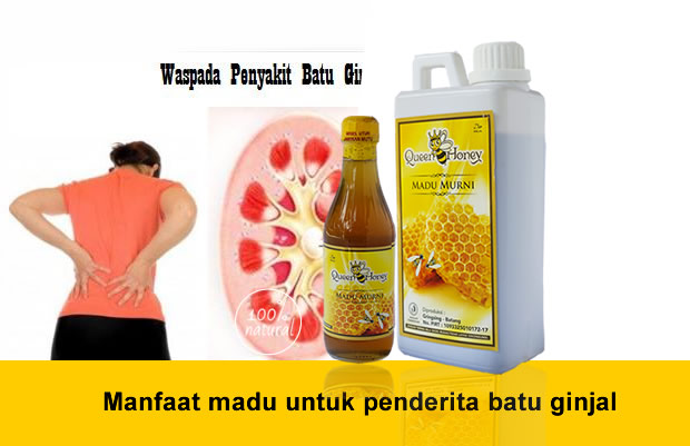 Manfaat madu untuk penderita batu ginjal
